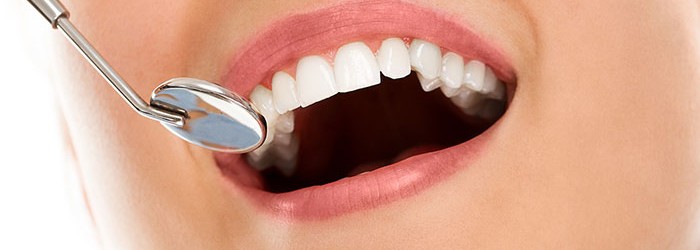 visita-dentista-700x250
